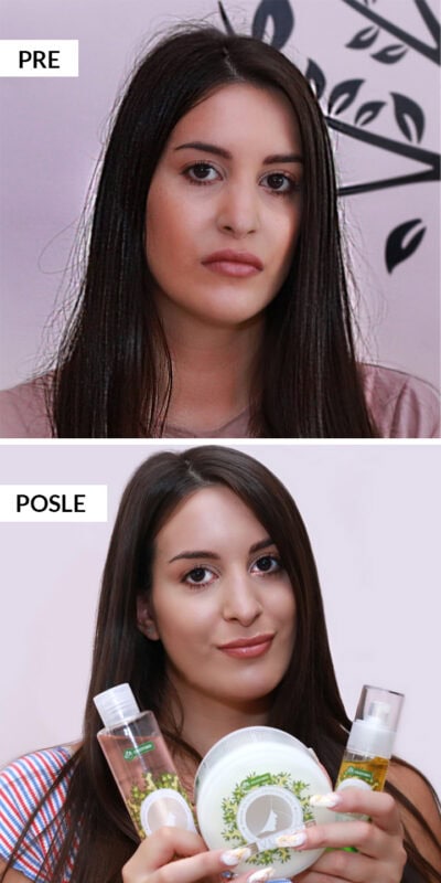 Nina-iskustvo Revlasin-pre-i-posle-2