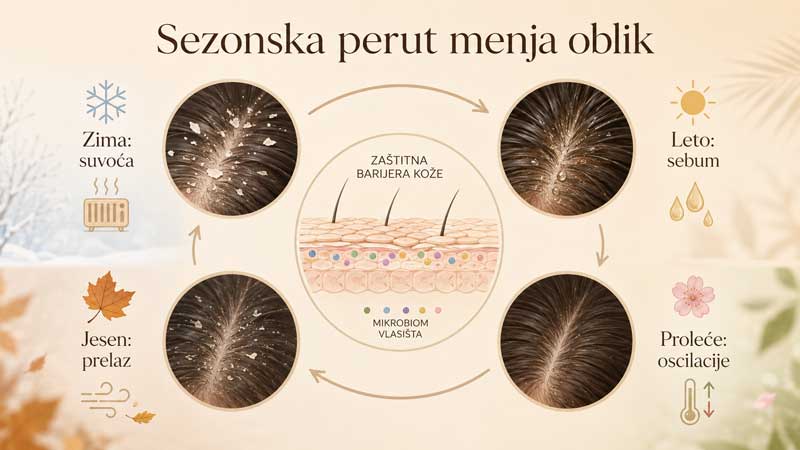 uzroci sezonske peruti uzroci sezonske peruti