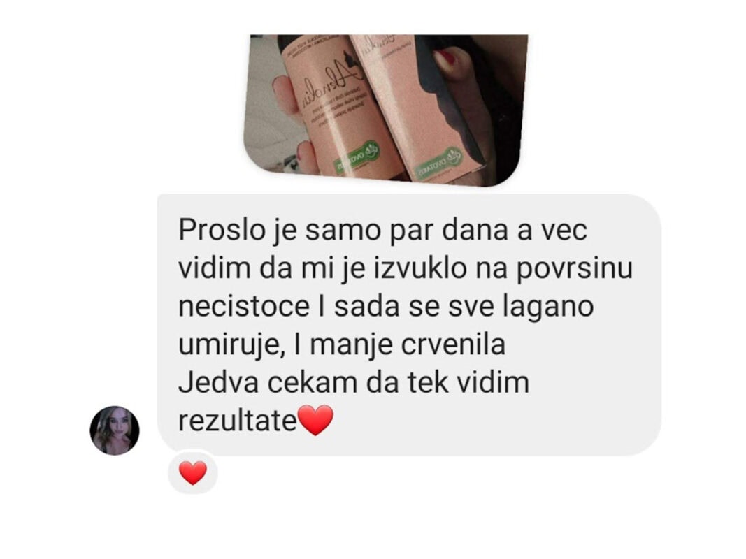 slika 5 aknolin iskustvo