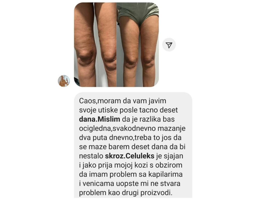 slika 7 celuleks iskustvo
